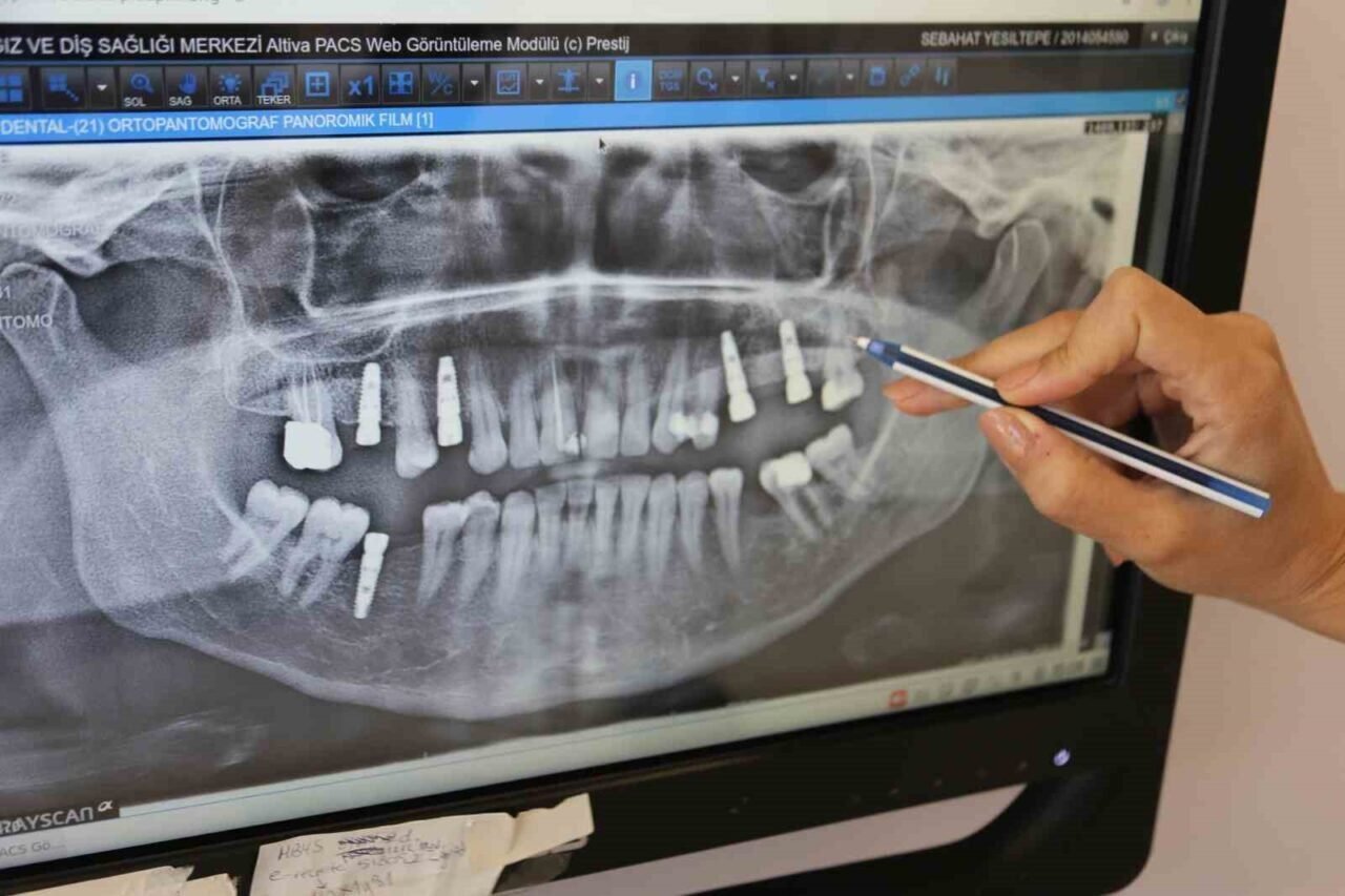 Manisa ADSM’de, implant uygulaması devam ediyor